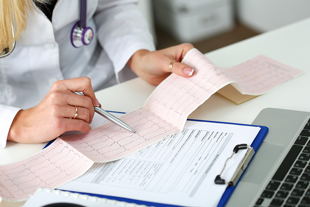 Cardiogram Chart Review